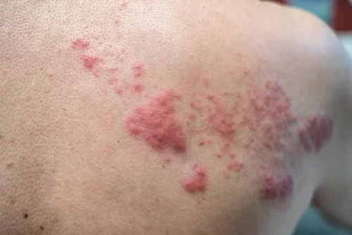 Wholesale Ivermectin Solutions for Parasitic Disease Management